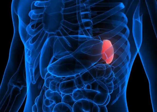Nowotwór śledziony objawy: jak je rozpoznać i kiedy szukać pomocy