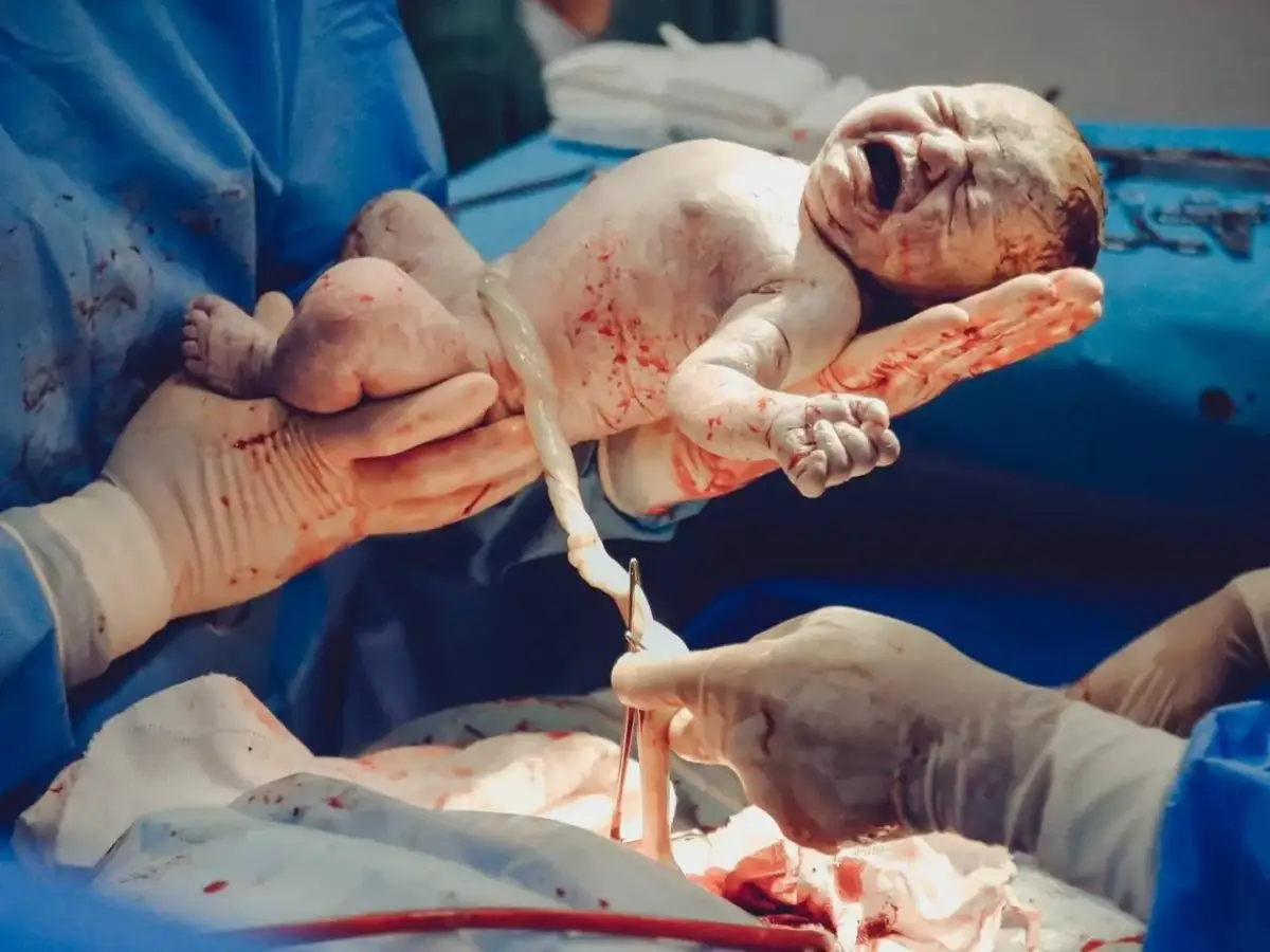 Nowe życie, pierwsza doba po cesarce. Dziecko trzymane przez dłonie w rękawiczkach, z pępowiną.