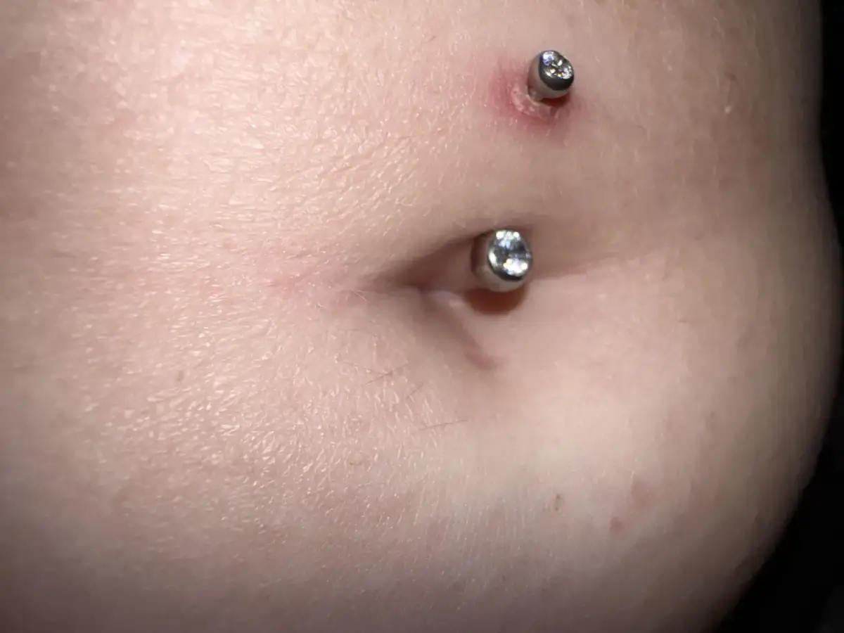 Jak przyspieszyć gojenie kolczyka w pepku i uniknąć infekcji