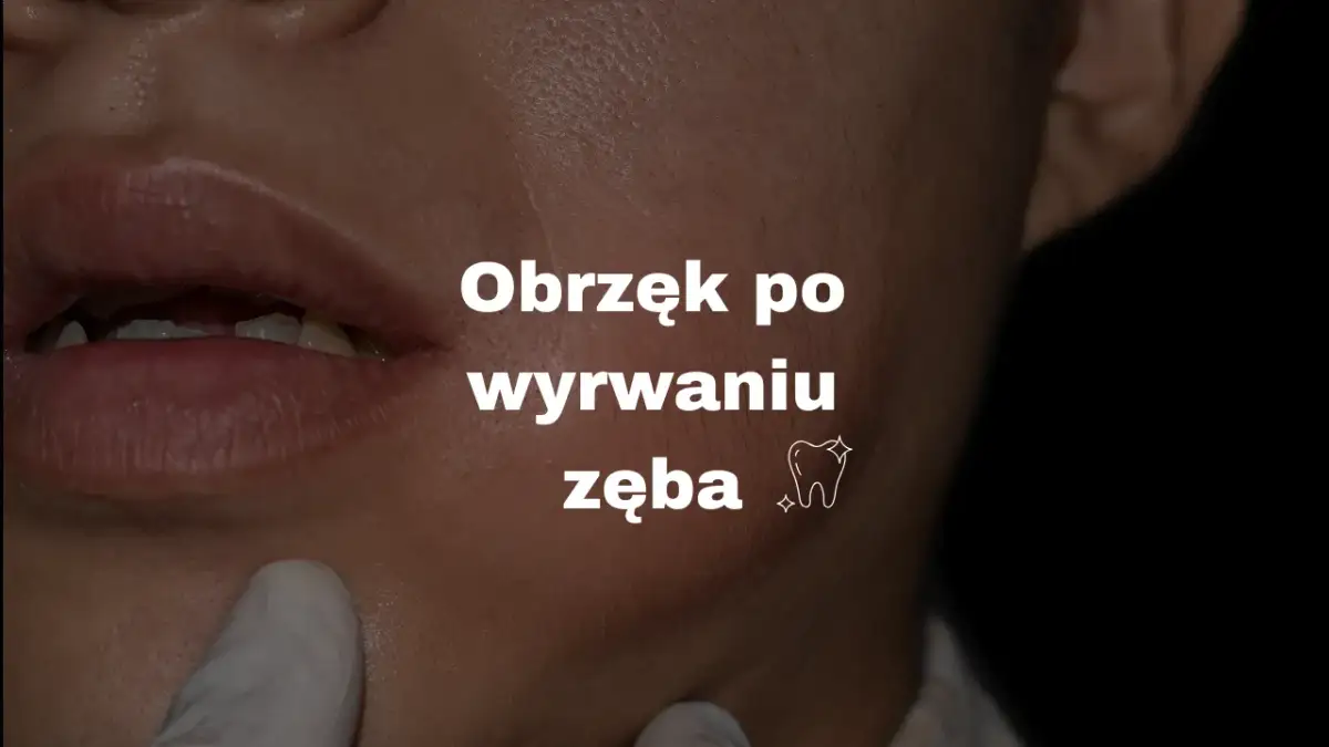 Ból i opuchlizna po wyrwaniu zęba: Co jest normą, a co niepokoi?