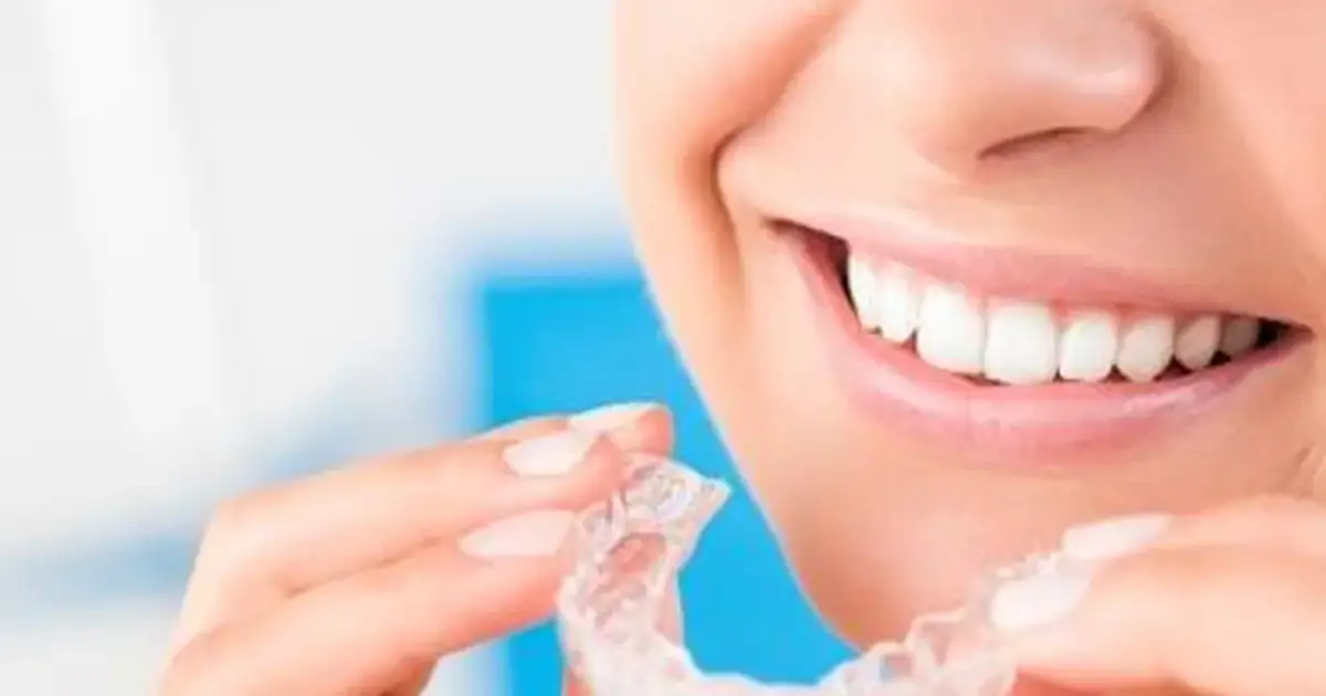 Aparat na zęby: ile naprawdę trwa leczenie? Poznaj sekrety ortodonty.