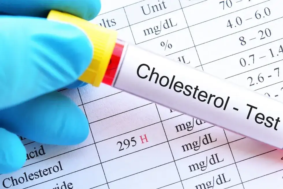 Jaki poziom cholesterolu jest odpowiedni dla wieku? Sprawdź normy i ryzyka