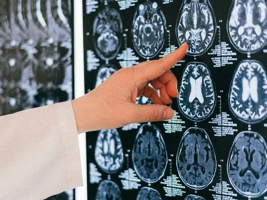 Guz mózgu objawy psychiczne - niebagatelizuj tych sygnałów zdrowotnych