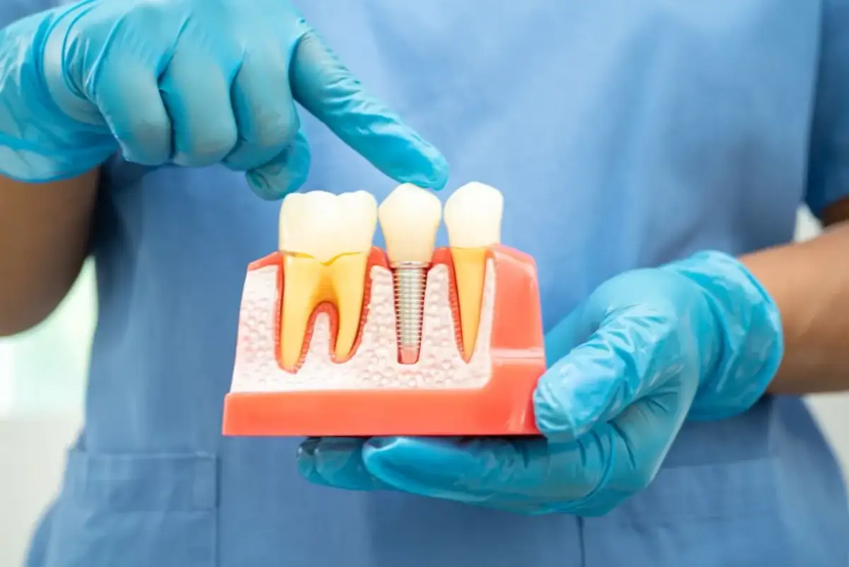 Lekarz dentysta a stomatolog: Czy to to samo? Rozwiewamy mity!