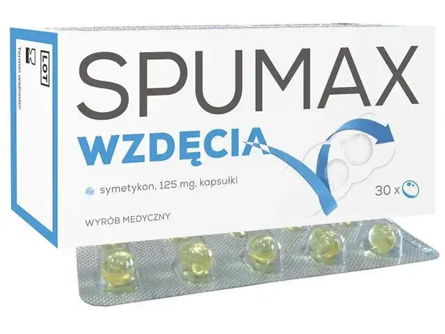 Jakie leki na gazy? 10 skutecznych sposobów na wzdęcia