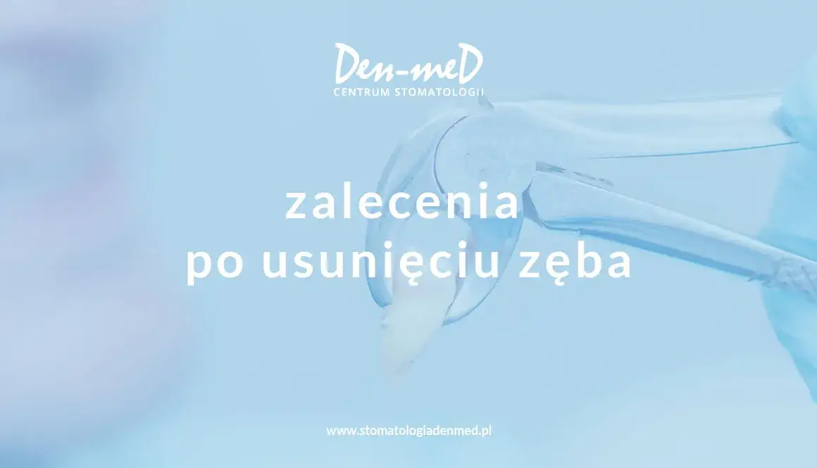 Antybiotyk po wyrwaniu zęba: Kiedy TAK, a kiedy NIE?