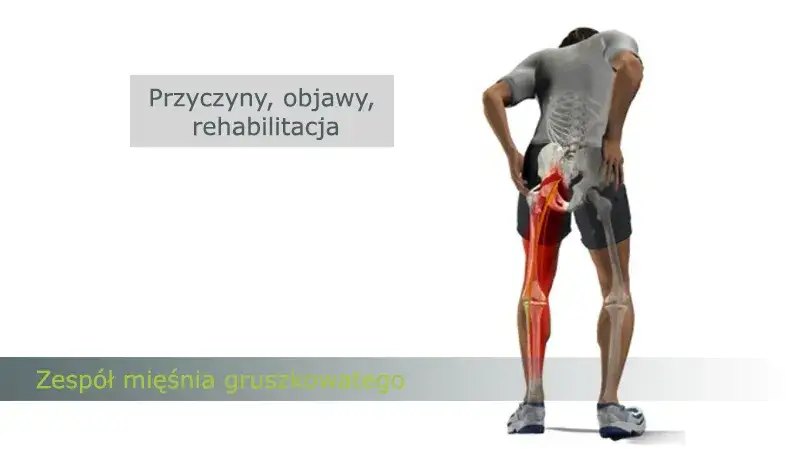 Zespół mięśnia gruszkowatego: do jakiego lekarza się udać i jak uniknąć błędów w leczeniu