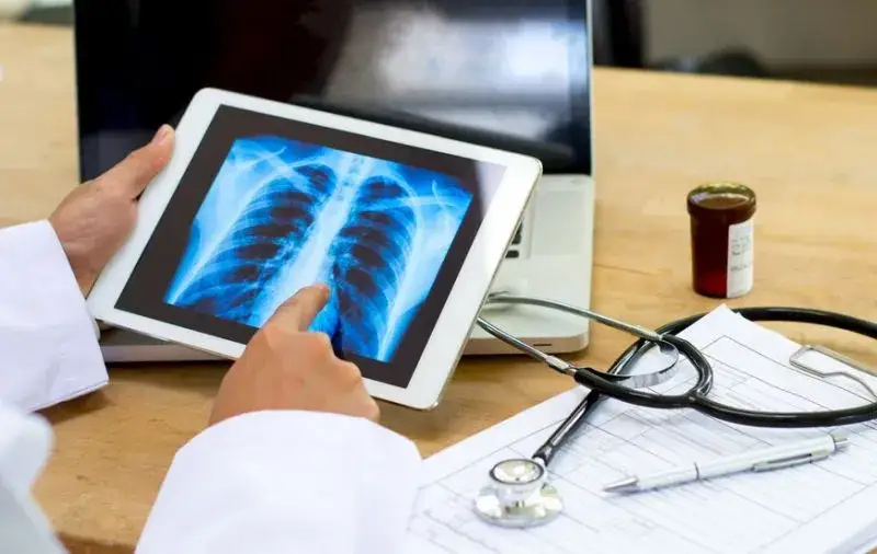 Objawy guzów płuc – co musisz wiedzieć, aby nie przegapić sygnałów