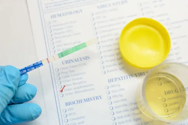 Podwyższony poziom białka w moczu: przyczyny, objawy i zagrożenia zdrowotne