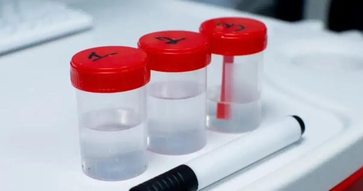 Jakie badania z kału pomogą w diagnostyce problemów zdrowotnych