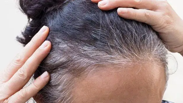 Siwienie włosów? Odkryj, jak opóźnić i zachować naturalny kolor.