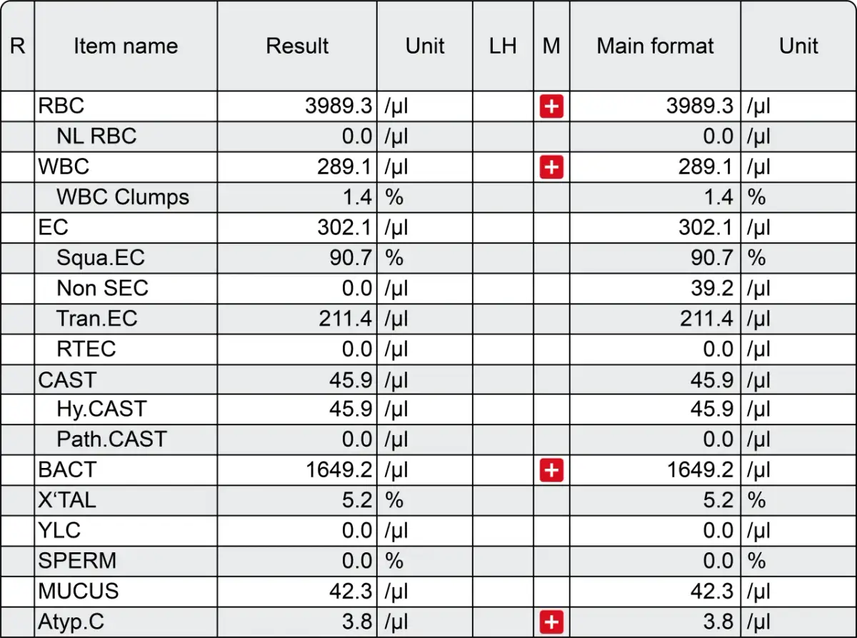 Czy badanie moczu wykryje raka? Sprawdź, co może ujawnić analiza moczu