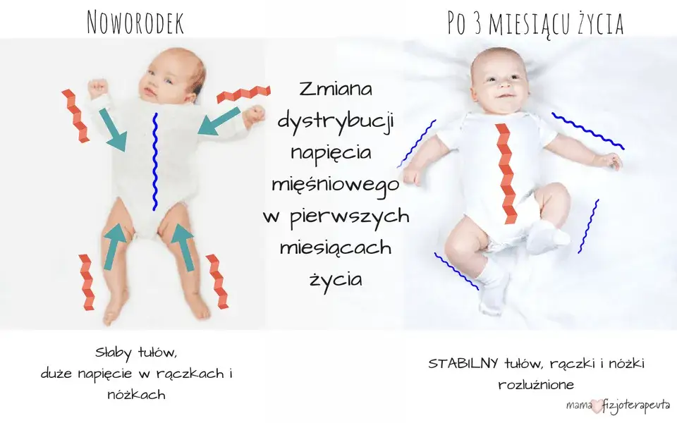 Wzmożone napięcie mięśniowe u niemowląt: Rozpoznaj objawy i działaj