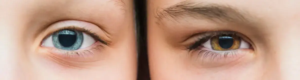 Do kiedy zmienia się kolor oczu? Fakty, które musisz znać