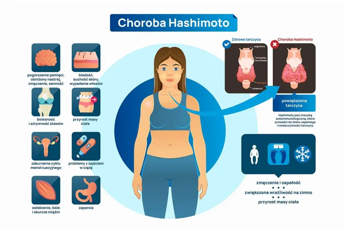Jakie badania są kluczowe w diagnostyce choroby Hashimoto?