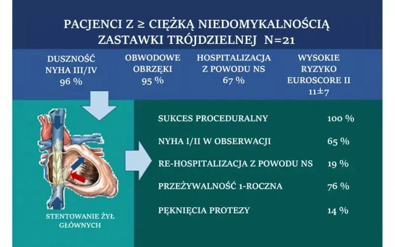 Niedomykalność zastawki objawy: jak je rozpoznać i co robić?