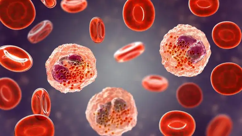 Podwyższony poziom eozynocytów - objawy, przyczyny i skutki zdrowotne