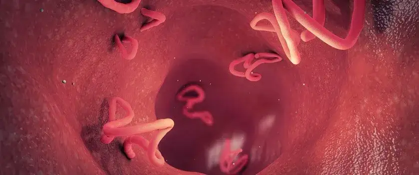 Robaki u dziecka objawy: Jak rozpoznać i uniknąć problemów zdrowotnych