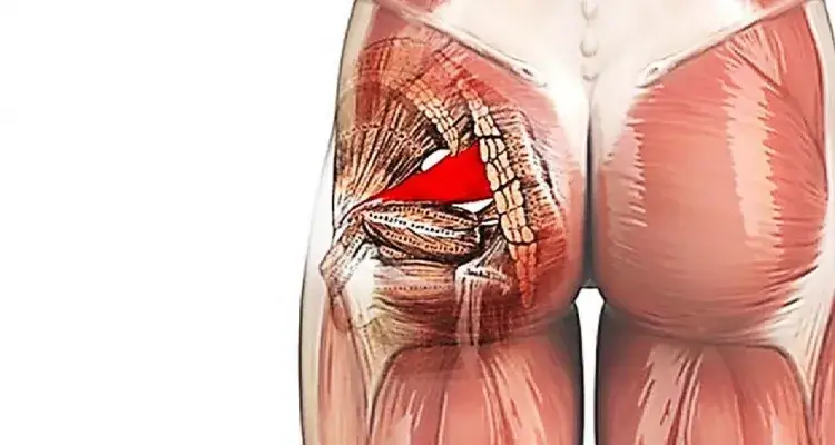 Dolor en el músculo piramidal: causas, síntomas y tratamientos efectivos
