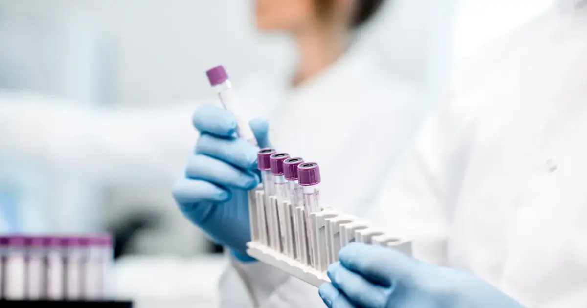 Badanie witaminy D3: Na czczo czy nie? Wszystko, co musisz wiedzieć