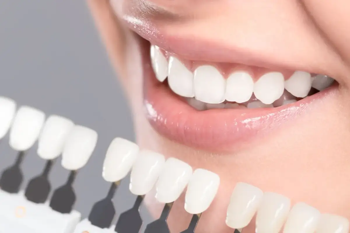 Wybielanie zębów sodą: Czy warto ryzykować? Opinia dentystów