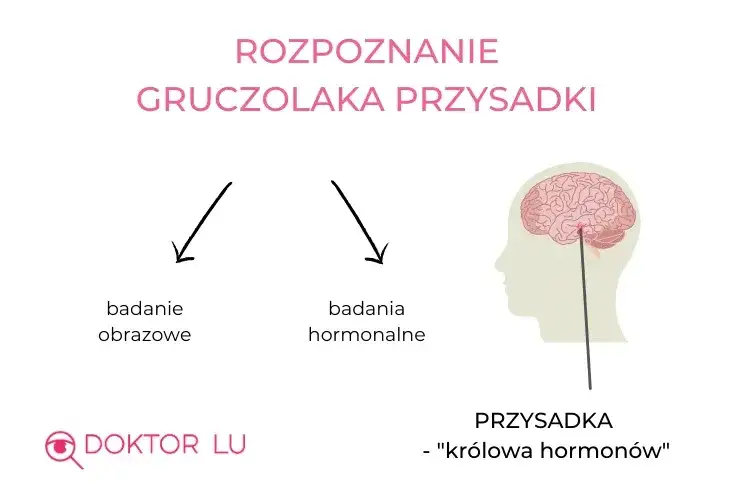 Gruczolak przysadki a psychika: objawy, leczenie, wsparcie
