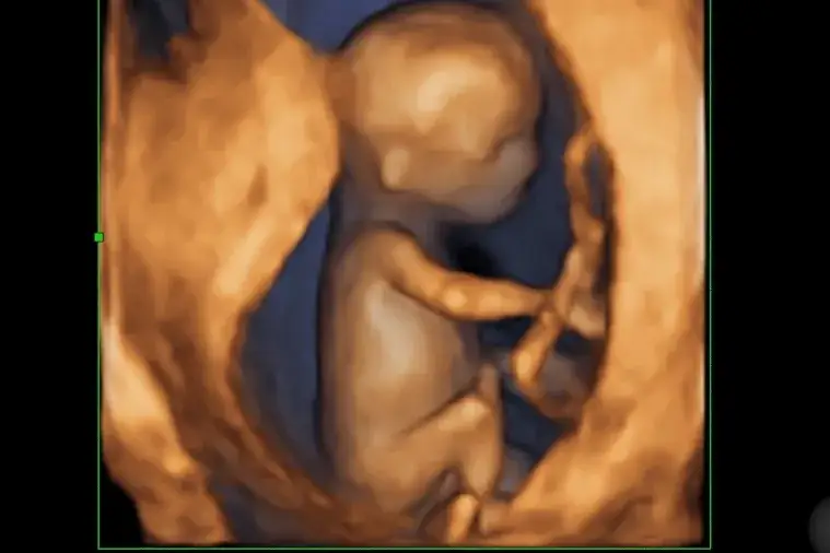 Kiedy zrobić badania prenatalne, aby uniknąć nieprawidłowości?