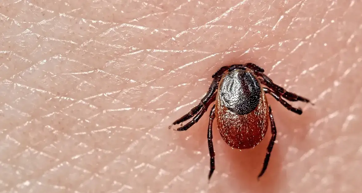Jakie badanie na boreliozę? Kluczowe informacje, które musisz znać