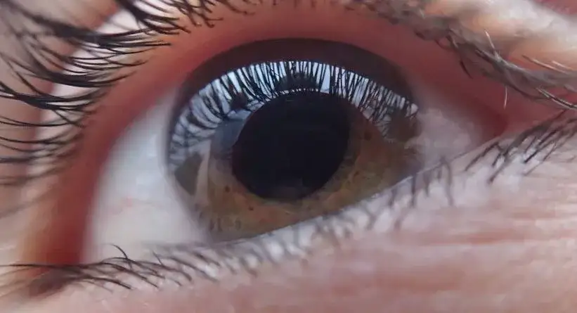 Czym się różni jaskra od zaćmy? Kluczowe różnice i objawy