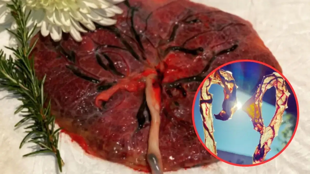 Co robią z łożyskiem po porodzie? 5 zaskakujących możliwości