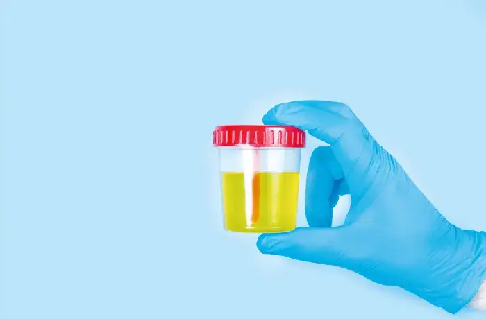 Jak długo mefedron jest wykrywany w moczu? Fakty, które musisz znać