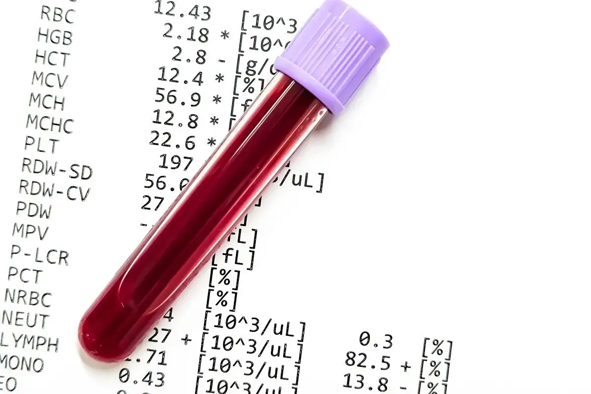 Probówka z krwią na tle wyników badań. Czy wyniki mieszczą się w **norma**?