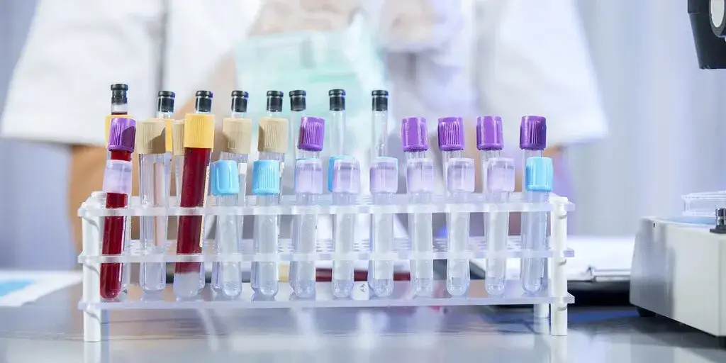 Jak uzupełnić niedobór sodu? Bezpieczne sposoby i sygnały alarmowe