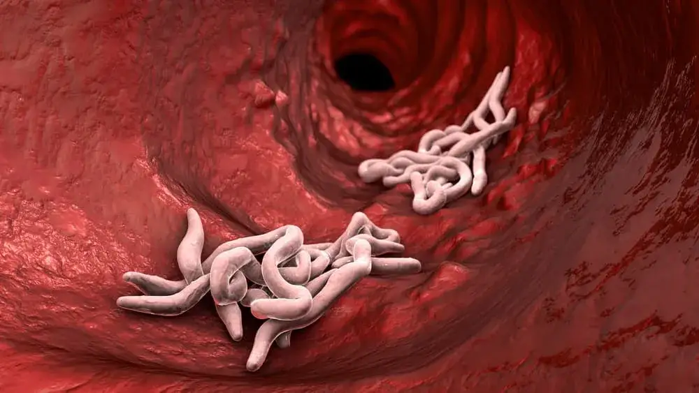 Jak sprawdzić czy dziecko ma owsiki? Objawy, diagnoza i leczenie