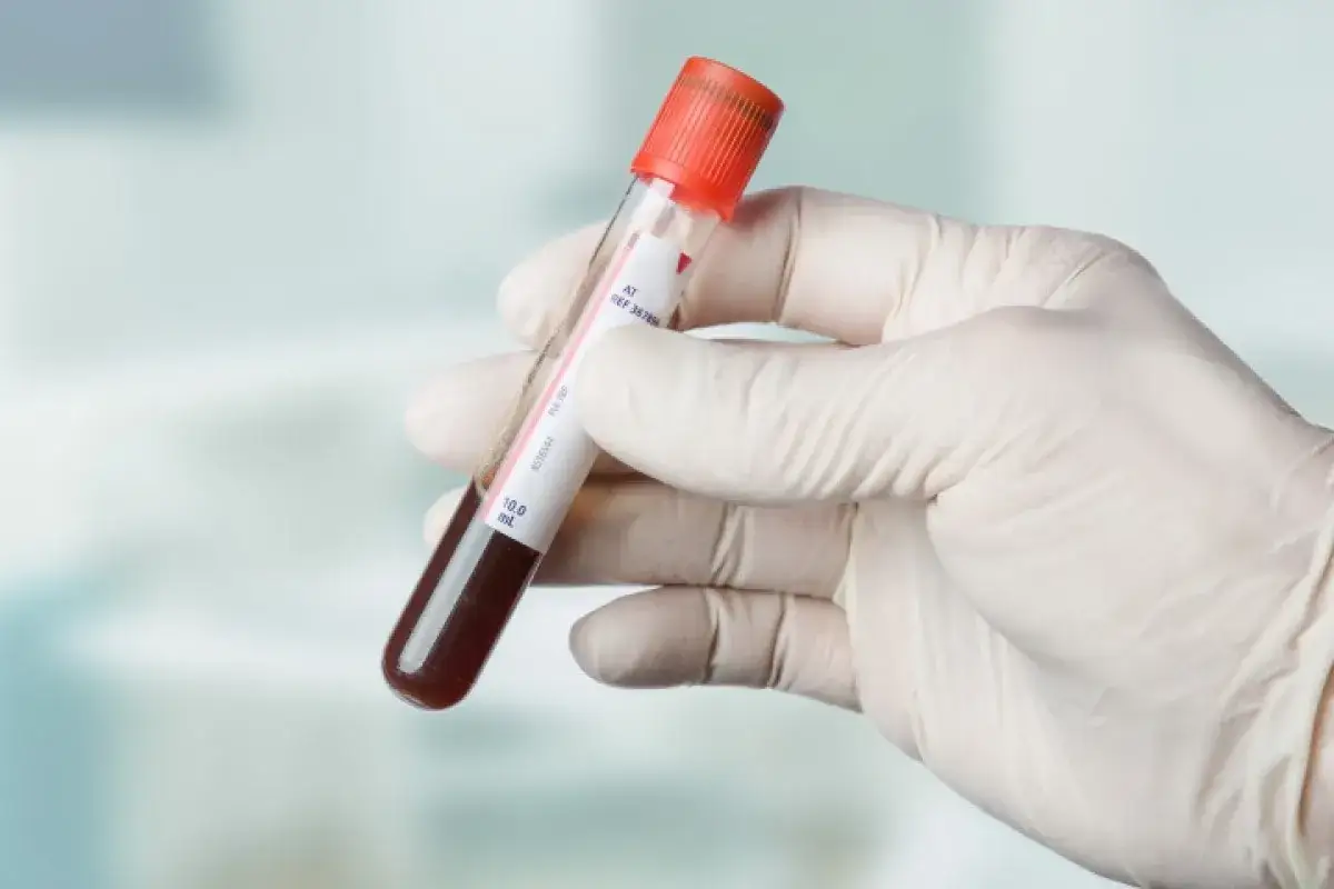 TSH: Co to za badanie? Czy Twoja tarczyca działa prawidłowo?