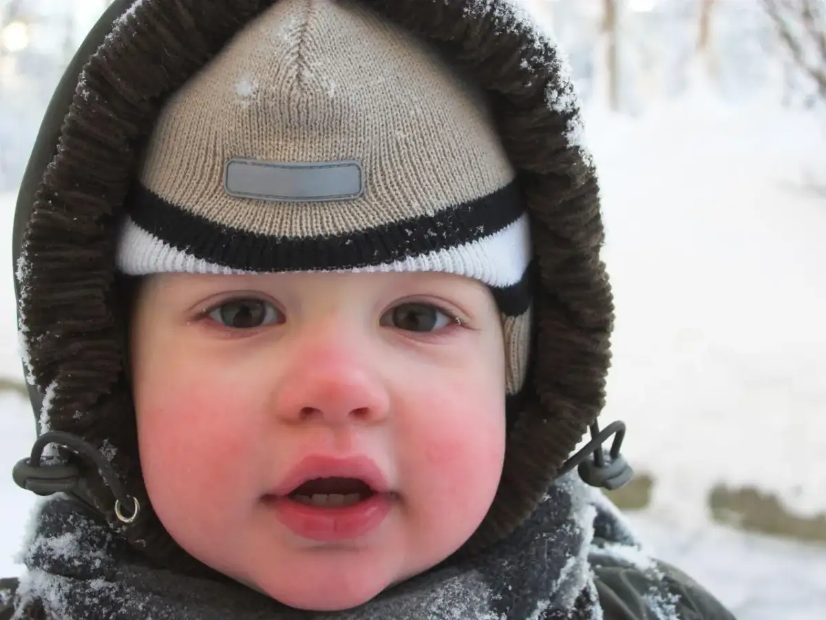 Czerwone policzki u niemowlaka - co smarować, aby ulżyć dziecku