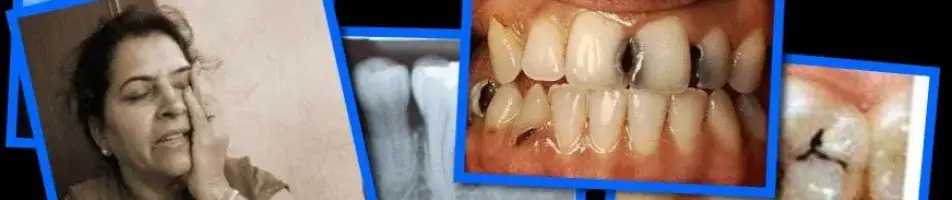 Kiedy można uprawiać sport po wyrwaniu zęba? Sprawdź, co musisz wiedzieć