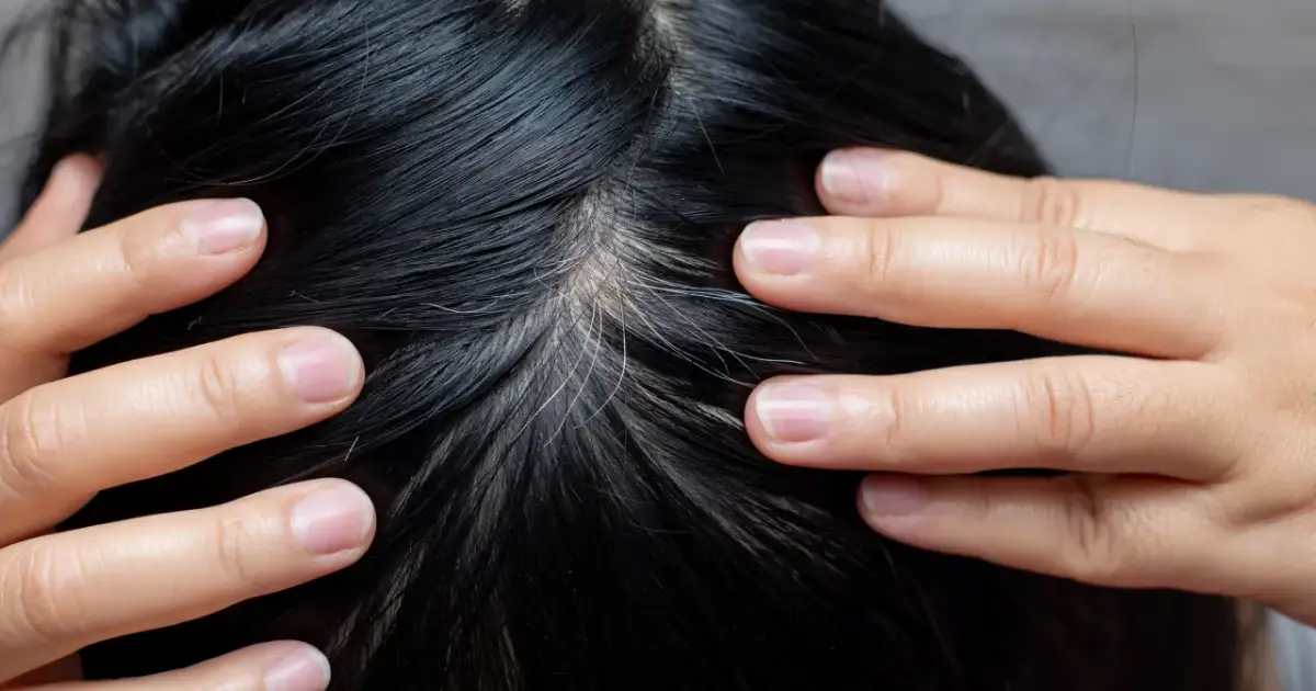 Dłonie dotykają czarnych włosów, wśród których widać pierwsze siwe włosy u nastolatków.