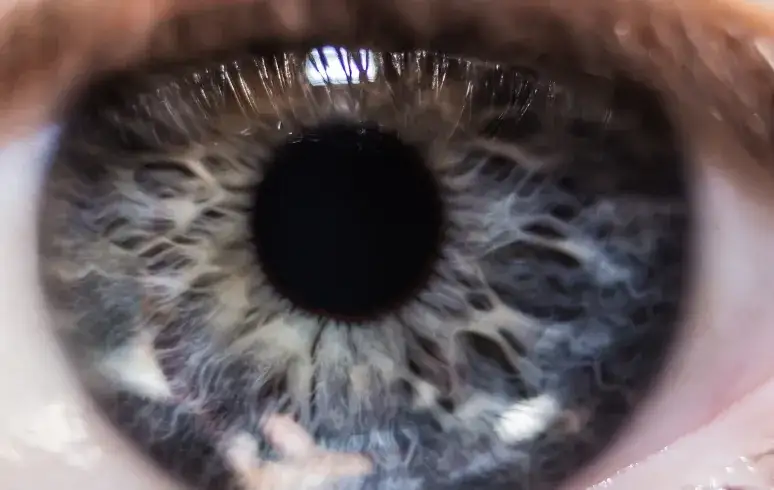 Jak się objawia zaćma? Objawy, które mogą zaskoczyć i zaniepokoić