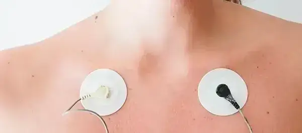 Holter EKG: Czy diagnozuje nerwicę serca? Odpowiedź eksperta