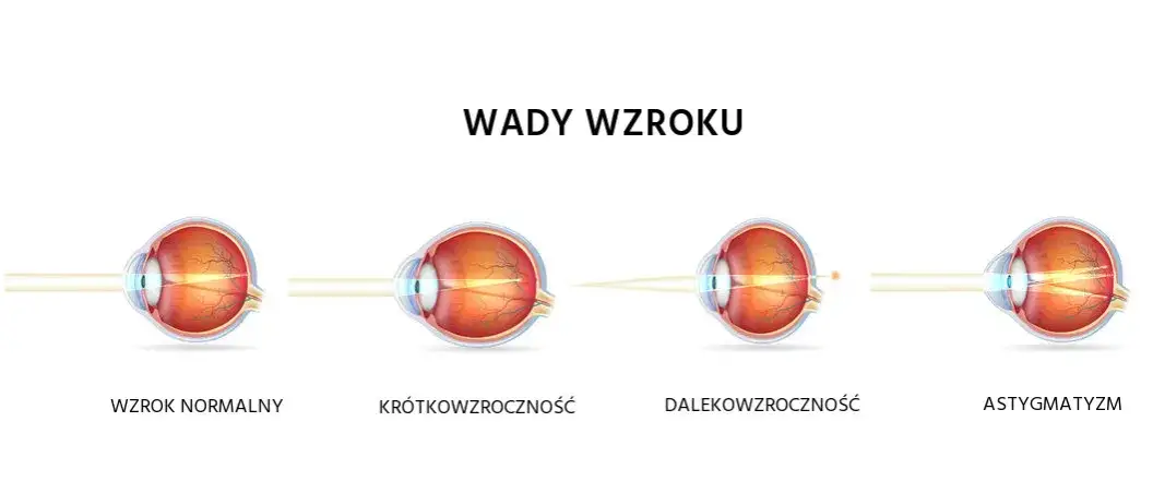 Krótkowzroczność a dalekowzroczność: Rozróżnij wady i zobacz lepiej!
