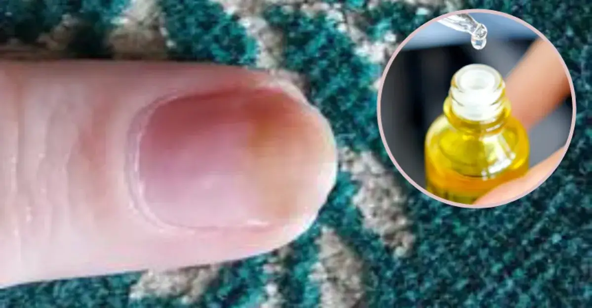 Jaki olejek na zniszczone paznokcie? Odkryj skuteczne rozwiązania