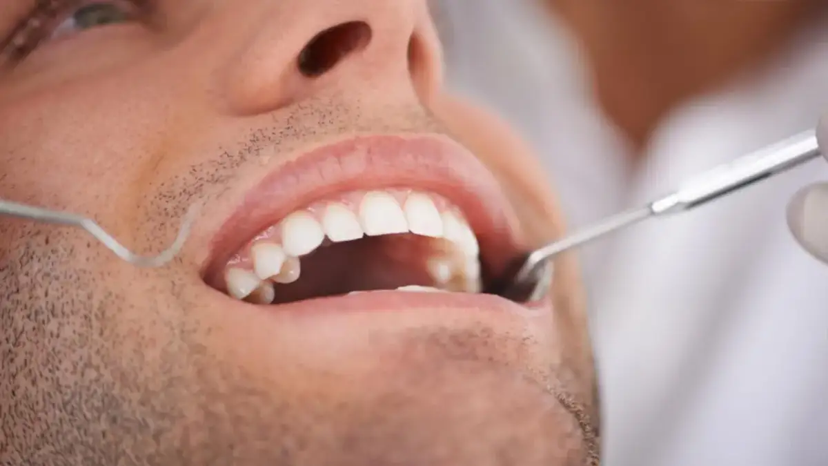 Ból zęba? Szybka ulga: domowe sposoby, leki i kiedy do dentysty