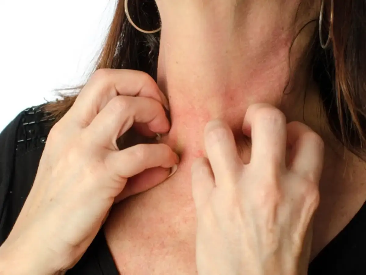 Swędzenie skóry alergicznej: Szybka ulga, domowe sposoby i kiedy do lekarza