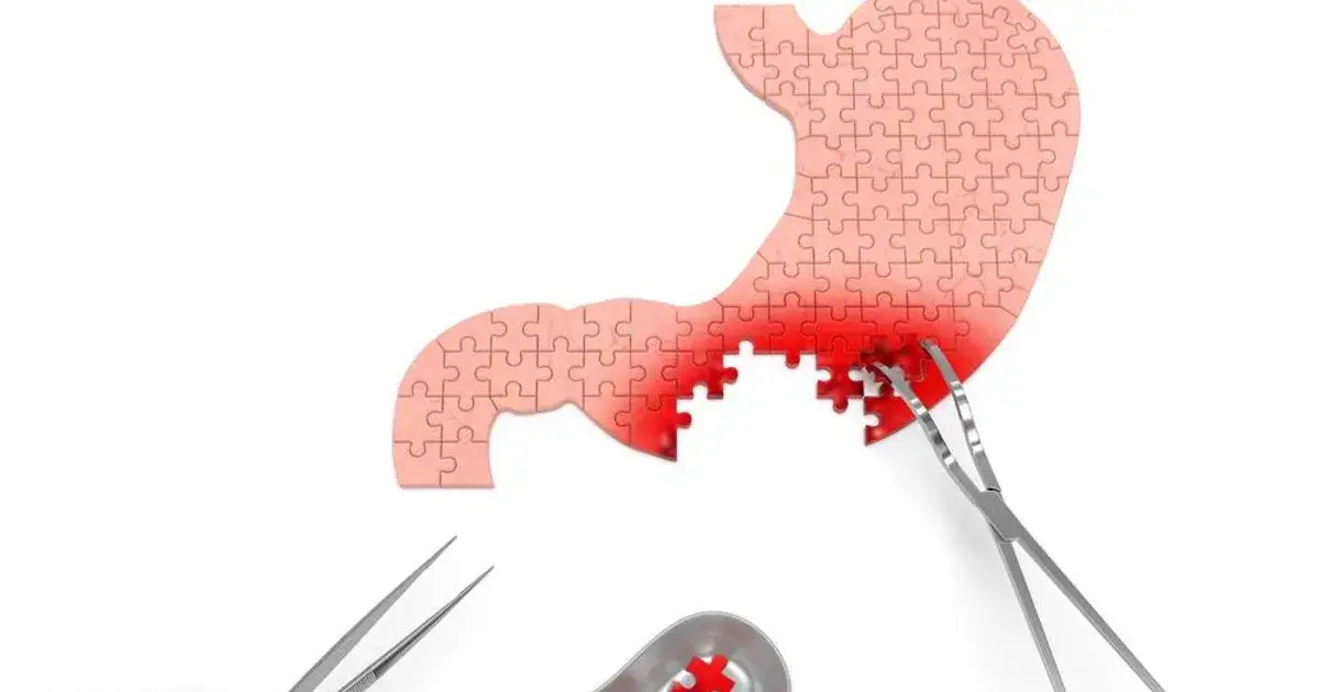 Czy piwo podrażnia żołądek? Oto, co musisz wiedzieć o skutkach