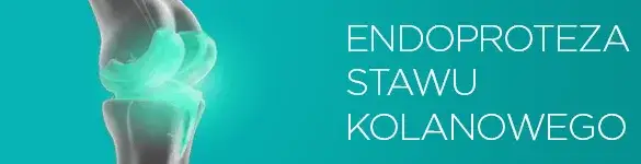 Jakie badania przed endoprotezą kolana? Kluczowe informacje i przygotowanie