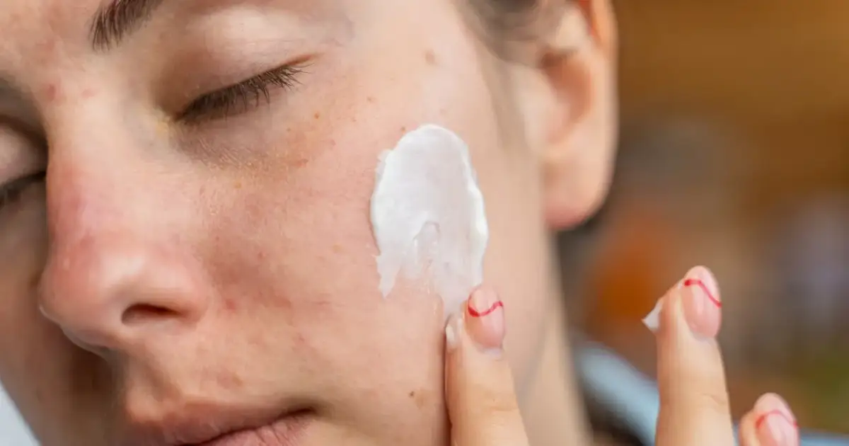 Kwas azelainowy i retinol to składniki aktywne w pielęgnacji skóry. Krem nakładany na twarz, widoczne piegi i zaczerwienienia.