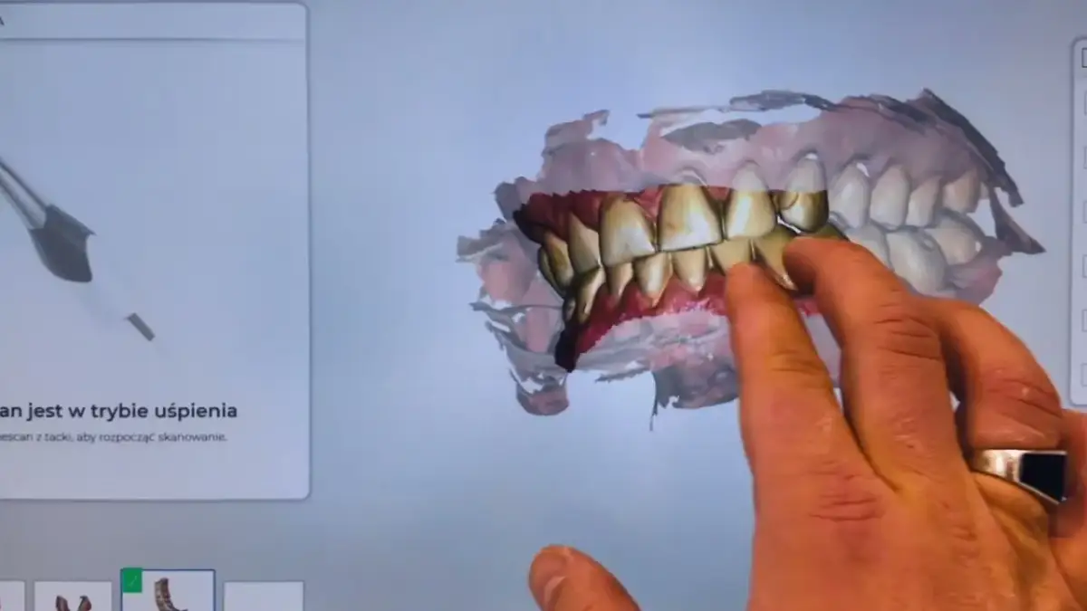 Co dentysta widzi? Więcej niż myślisz - poznaj prawdę
