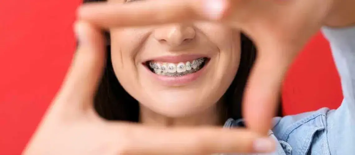 Jak działa aparat ortodontyczny i co powinieneś o nim wiedzieć