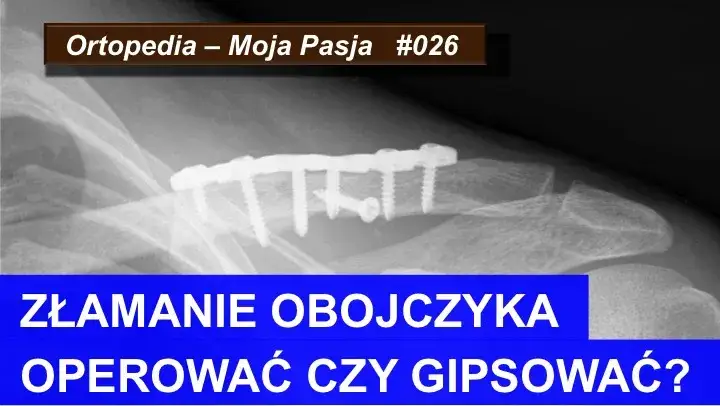 Złamanie kości: Ortopeda czy chirurg? Kto naprawdę Ci pomoże?